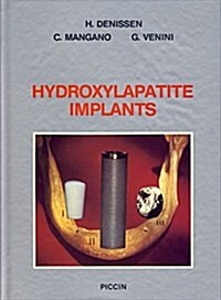 Hydroxylapatite Implants (Hardcover)