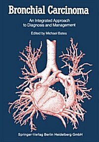 Bronchial Carcinoma : An Integrated Approach to Diagnosis and Management (Paperback, Softcover reprint of the original 1st ed. 1984)