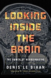 Looking Inside the Brain: The Power of Neuroimaging (Hardcover)
