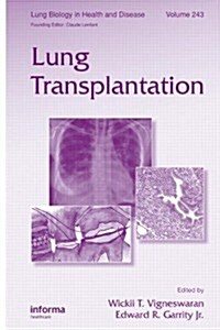 Lung Transplantation (Hardcover)