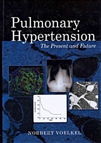 Pulmonary Hypertension: The Present and Future (Hardcover)