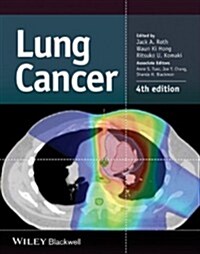 Lung Cancer (Hardcover, 4 ed)