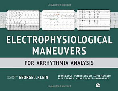 Electrophysiological Maneuvers for Arrhythmia Analysis (Paperback)