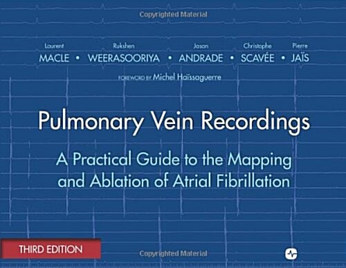 Pulmonary Vein Recordings: A Practical Guide to the Mapping and Ablation of Atrial Fibrillation (Paperback, 3, Revised)