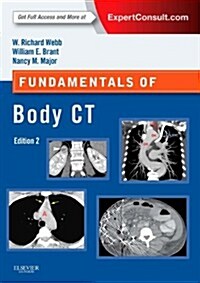 Fundamentals of Body CT: Expert Consult - Online and Print (Paperback, 4, Revised)