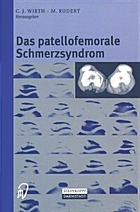 Das Patellofemorale Schmerzsyndrom (Paperback, 2000)