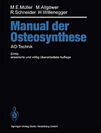 Manual Der Osteosynthese: Ao-Technik (Paperback, 3, 3. Aufl. 1992.)