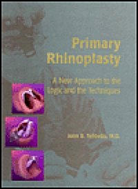 Primary Rhinoplasty (Hardcover)
