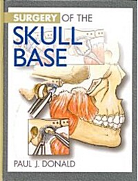 Surgery of the Skull Base (Hardcover)