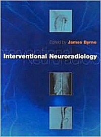 Interventional Neuroradiology: Theory and Practice (Hardcover)