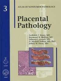 Placental pathology