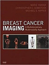 [중고] Breast Cancer Imaging (Hardcover, 1st)
