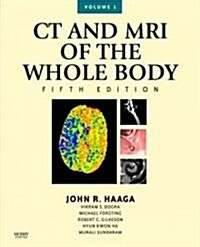 CT and MRI of the Whole Body, 2-Volume Set (Hardcover, 5, Revised)