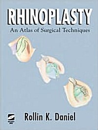 Rhinoplasty: An Atlas of Surgical Techniques (Hardcover)