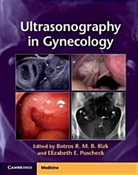 Ultrasonography in Gynecology (Hardcover)