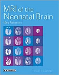 Mri of the Neonatal Brain (Hardcover)