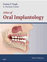Atlas of Oral Implantology (Hardcover, 3rd)