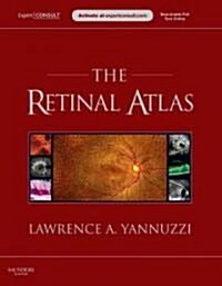 [중고] The Retinal Atlas (Package)