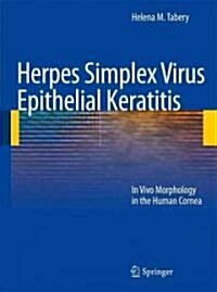 Herpes Simplex Virus Epithelial Keratitis: In Vivo Morphology in the Human Cornea (Paperback, 2010)