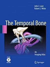 The Temporal Bone: An Imaging Atlas [With CDROM] (Hardcover, 2010)