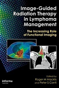 Image-Guided Radiation Therapy in Lymphoma Management: The Increasing Role of Functional Imaging (Hardcover)