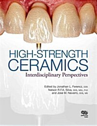 High-Strength Ceramics (Hardcover, 1st)