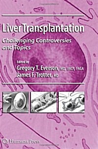 Liver Transplantation: Challenging Controversies and Topics (Paperback)