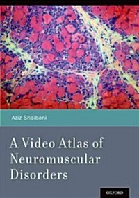 A Video Atlas of Neuromuscular Disorders [With CDROM] (Paperback)