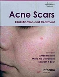 Acne Scars : Classification and Treatment (Hardcover)