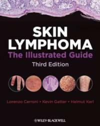 Skin lymphoma : the illustrated guide 3rd ed