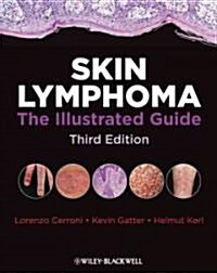 Skin Lymphoma: The Illustrated Guide (Hardcover, 3rd)
