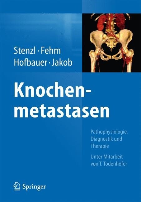 Knochenmetastasen: Pathophysiologie, Diagnostik Und Therapie - Unter Mitarbeit Von T. Todenh?er (Hardcover, 2014)