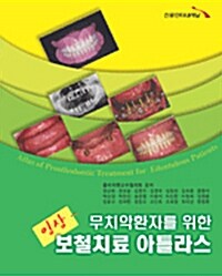 임상 보철치료 아틀라스