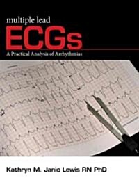 Multiple Lead ECGs: A Practical Analysis of Arrhythmias (Paperback)