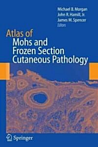 Atlas of Mohs and Frozen Section Cutaneous Pathology (Hardcover)