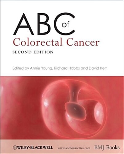ABC of Colorectal Cancer (Paperback, 2)