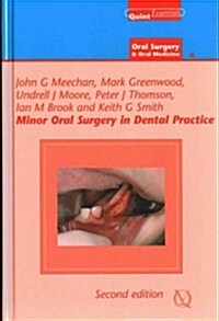 Minor Oral Surgery in Dental Practice (Hardcover, 2, Revised)