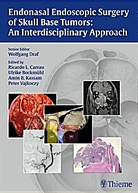 Endonasal Endoscopic Surgery of Skull Base Tumors: An Interdisciplinary Approach (Hardcover)