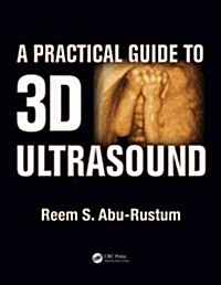 A Practical Guide to 3D Ultrasound (Paperback)