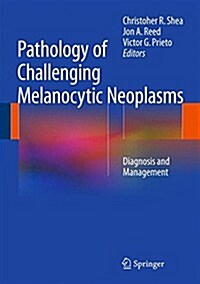 Pathology of Challenging Melanocytic Neoplasms: Diagnosis and Management (Hardcover, 2015)