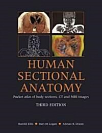 Human Sectional Anatomy : Pocket Atlas of Body Sections, CT and MRI Images (Paperback, 3 Rev ed)