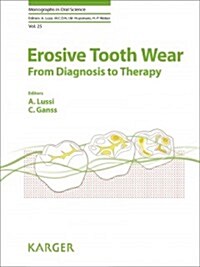 Erosive Tooth Wear (Hardcover, 2nd, Revised)