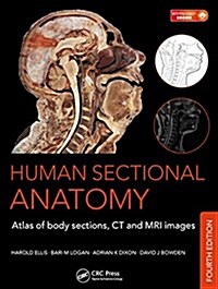Human Sectional Anatomy: Atlas of Body Sections, CT and MRI Images, Fourth Edition (Hardcover, 4)