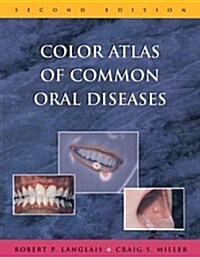 Color Atlas of Common Oral Diseases (Paperback, 2nd)