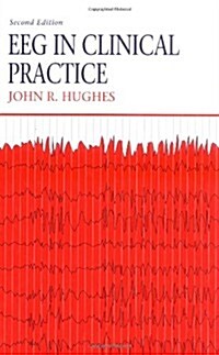 EEG in Clinical Practice, 2e (Paperback, 2nd)