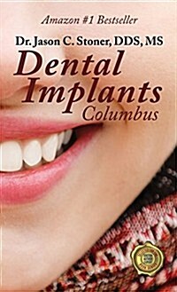 Dental Implants Columbus (Hardcover)