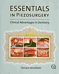 Essentials in Piezosurgery: Clinical Advantages in Dentistry (Hardcover)