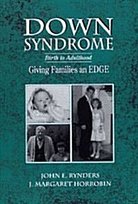 Downs Syndrome (Paperback)
