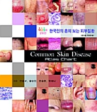 색상별로 분류한 한국인의 흔히 보는 피부질환
