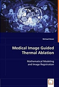 Medical Image Guided Thermal Ablation (Paperback)